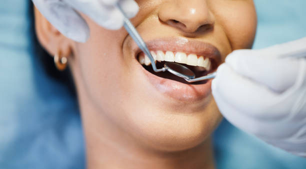 Best Emergency Treatment for Toothache in Aurora, OH
